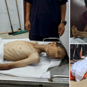 gazzede yetersiz beslenme nedeniyle 30 yasindaki filistinli hayatini kaybetti vEQ3yvUs