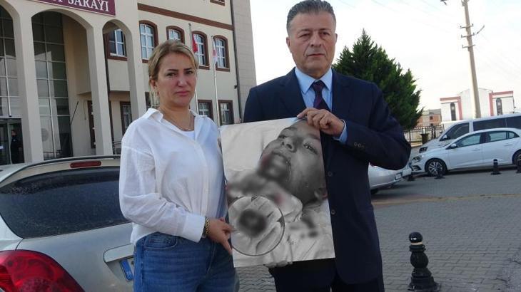 okulda korkunc olay 7 yasindaki kuzey yigitin demir saplanan cenesi koptu XACX41EI.jpg